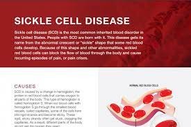 moj of sickle cell deseases